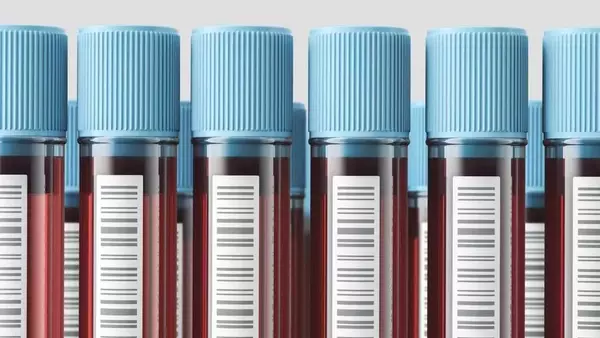 Direct-to-Consumer Blood Testing: Empowerment or Peril?