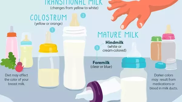 Understanding the Diverse Hues of Breast Milk: A Comprehensive Guide