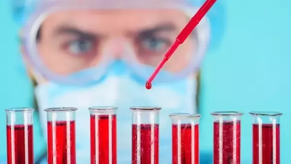 Immix Biopharma: Analyst Bullish but Flags Safety and Adoption Questions